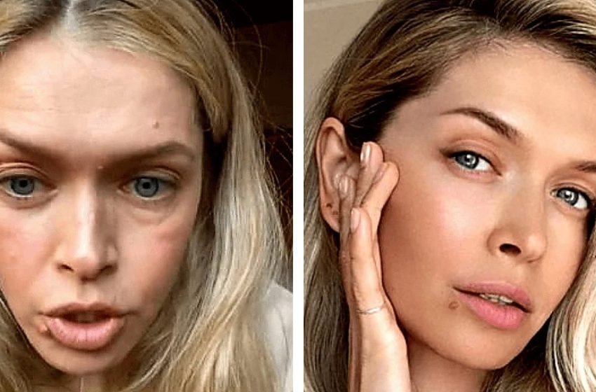  К такому тренду не все готовы: 15 снимков наших знаменитостей без макияжа, которые вас поразят