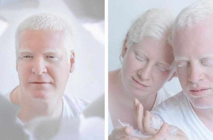  «Внеземная красота»: Фотографии людей-альбиносов, поражающих своей невероятной внешностью