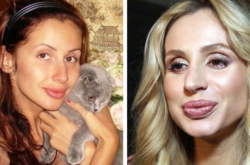 Подкорректировали губы, нос, скулы: звезды, которых не узнать на фотографиях «до» пластики