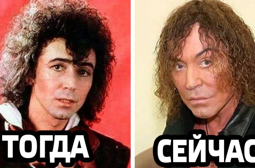 «До» было лучше: знаменитости, которые стали хуже выглядеть после пластики